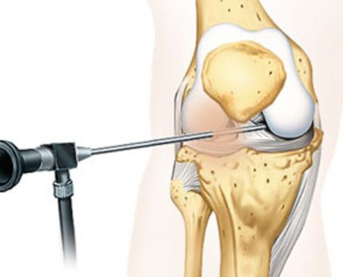 Spezialist für Kniearthroskopie Wien